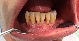 Denti Malati 