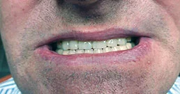 testimonianze dentali